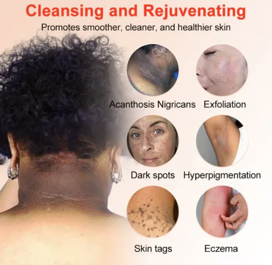 Orange Enzyme Exploiting Gel - Buy 1 Get 1 Free