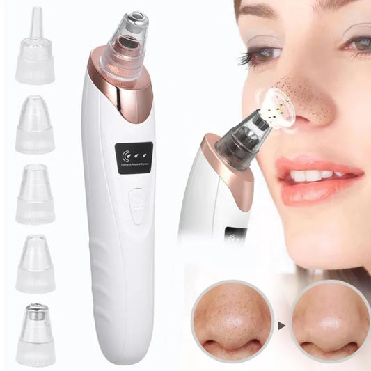 Electric Blackhead Remover | Rechargeable Pore Vacuum with 5 Interchangeable Heads