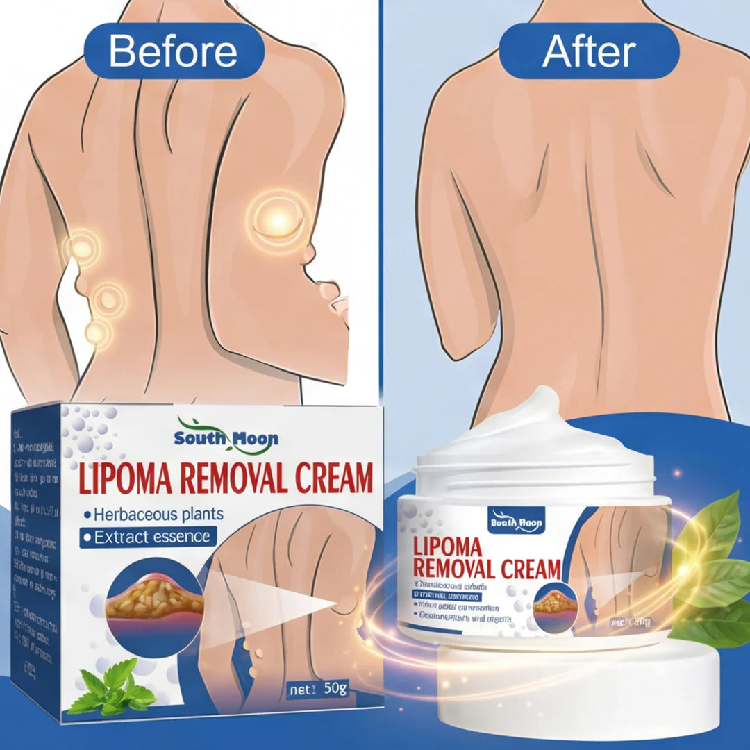 Lipoma Removal And Body Smoothing Cream (50 Grams)