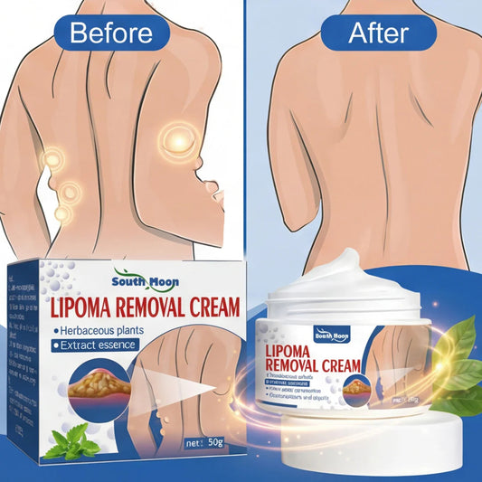Lipoma Removal And Body Smoothing Cream (50 Grams)