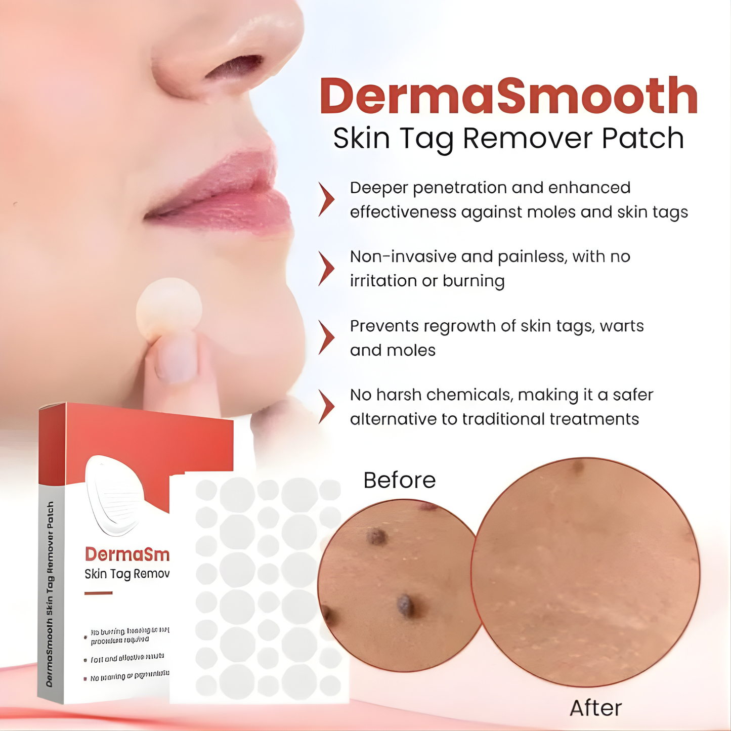 DermaSmooth Skin Tag, Moles & Warts Remover (72 Patches)